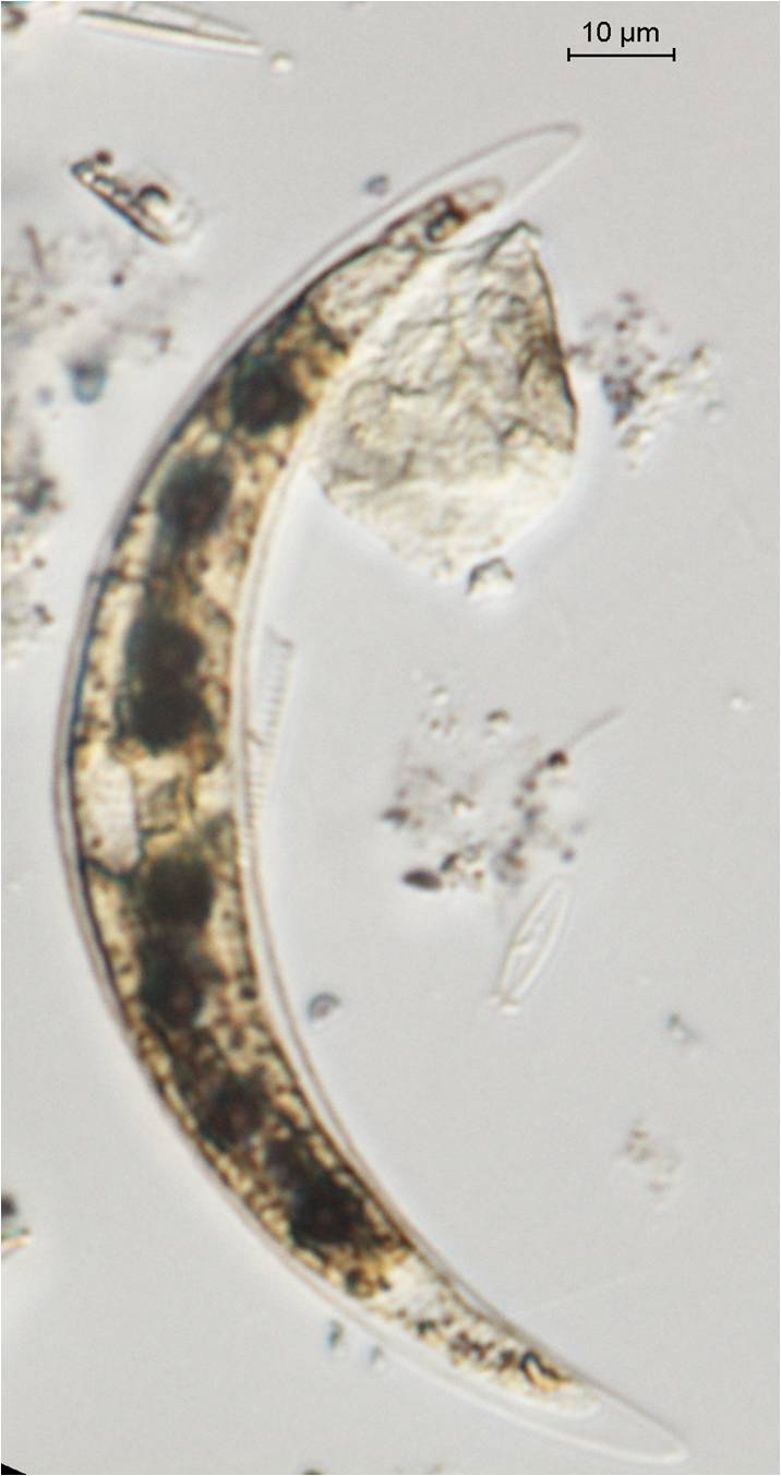 Diatom Closterium dianae